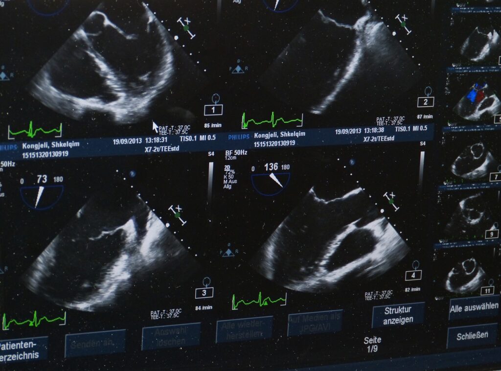 ultrasound, x-ray image, hospital-509396.jpg